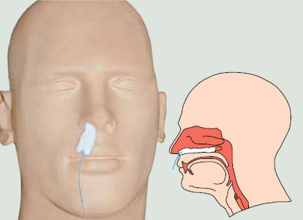 وسادة أنفية جراحية
