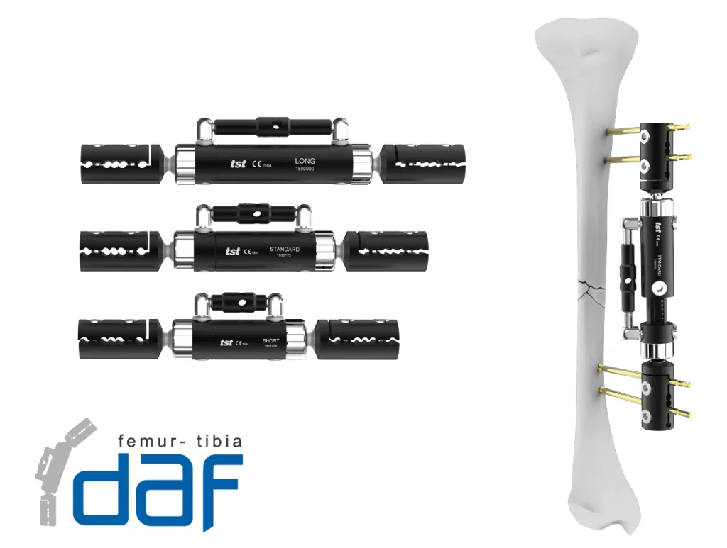 مثبت خارجي ديناميكي DAF Femur-Tibia